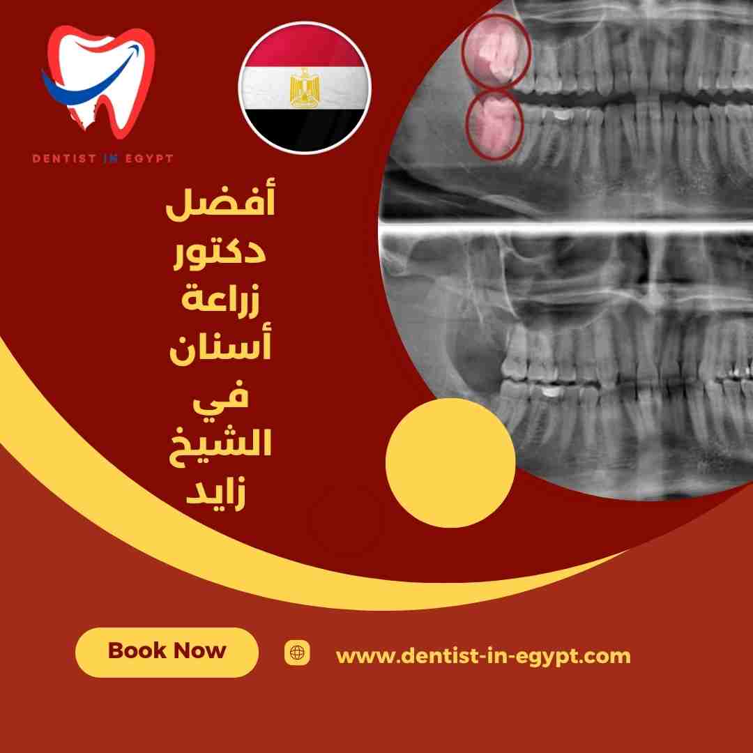 أفضل دكتور أسنان في الشيخ زايد