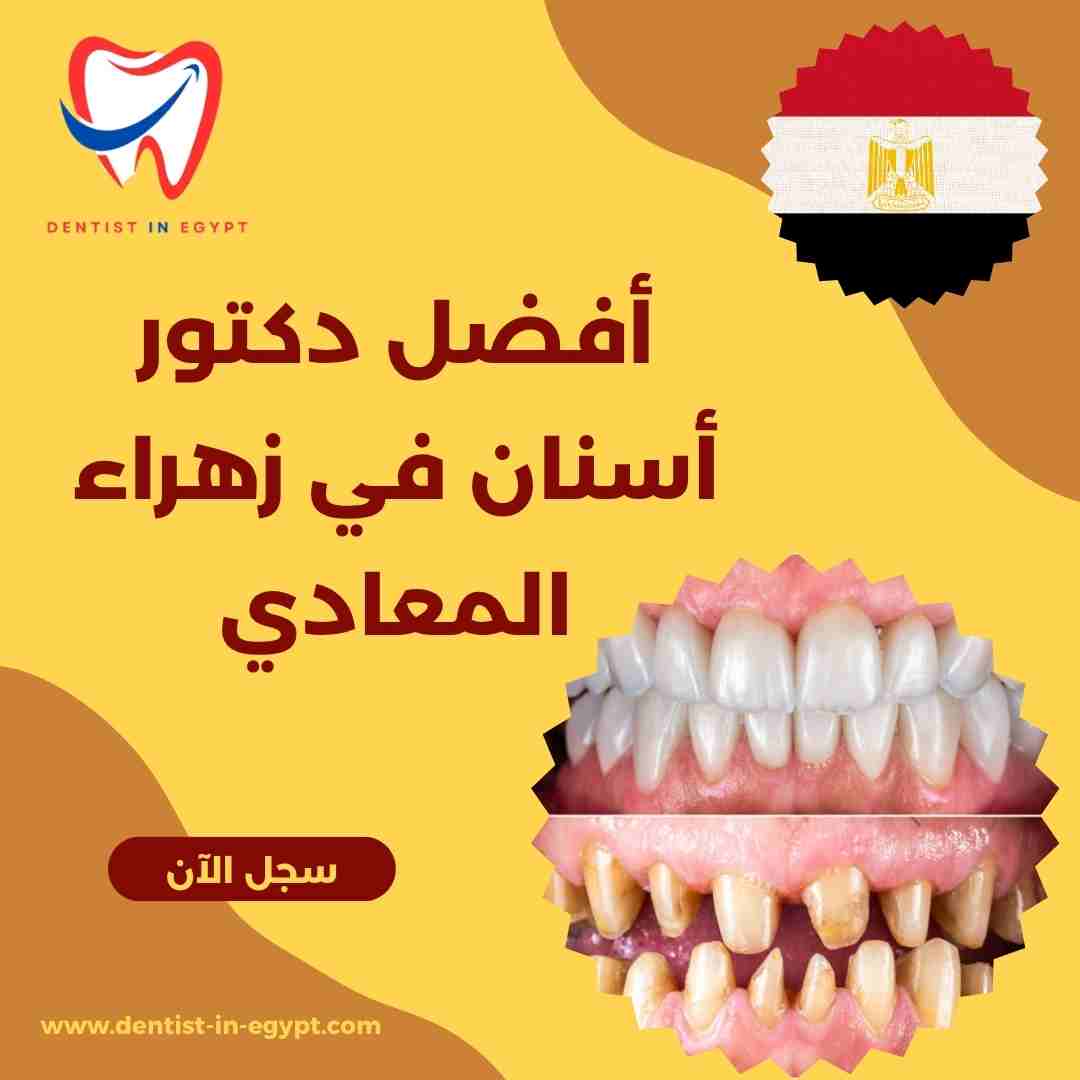أفضل دكتور أسنان في زهراء المعادي