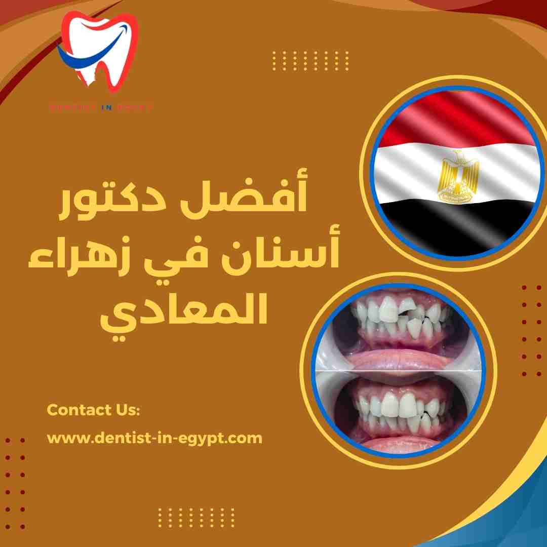 أفضل دكتور أسنان في زهراء المعادي