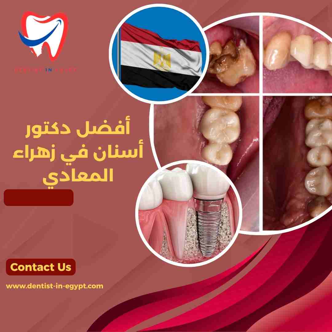 أفضل دكتور أسنان في زهراء المعادي