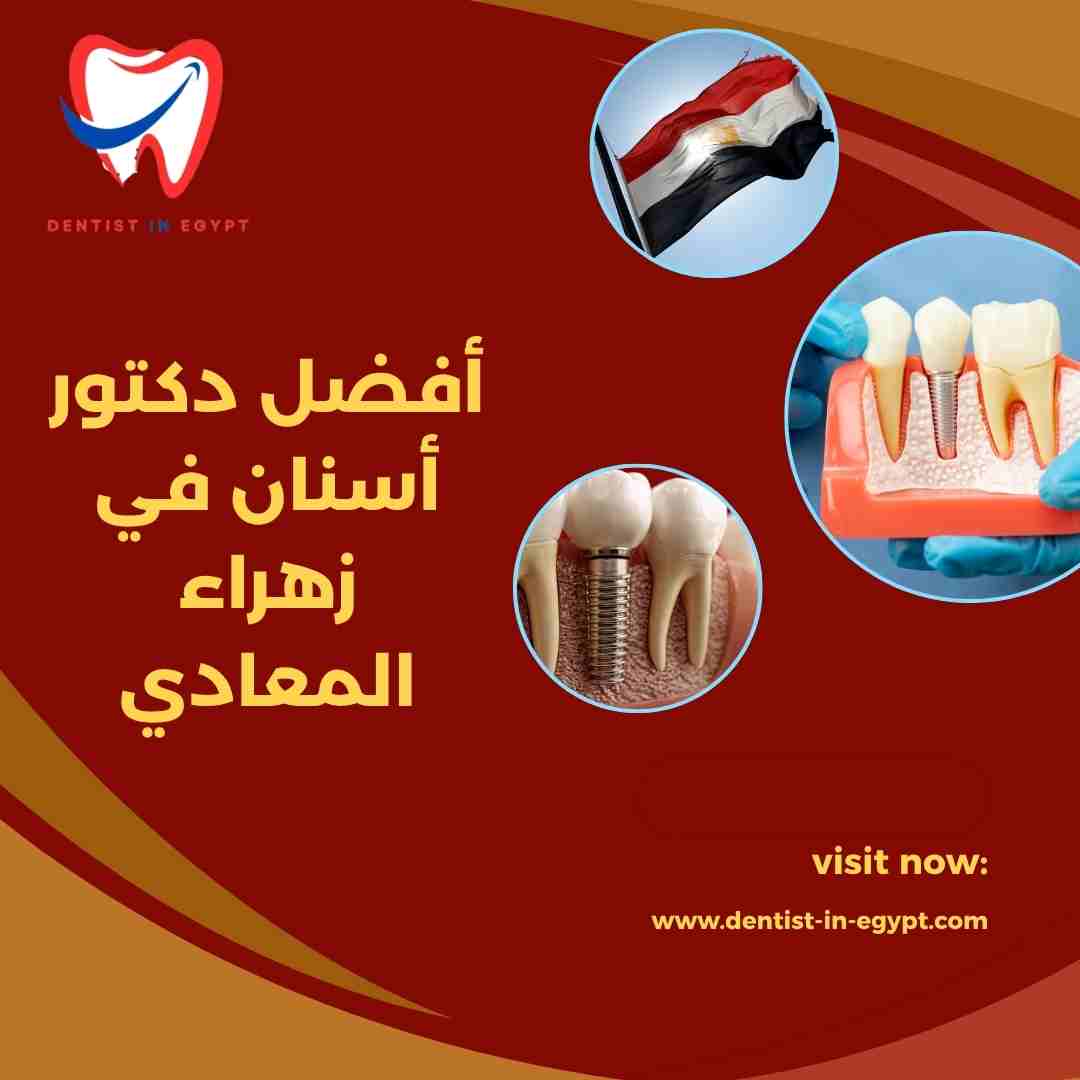 أفضل دكتور أسنان في زهراء المعادي