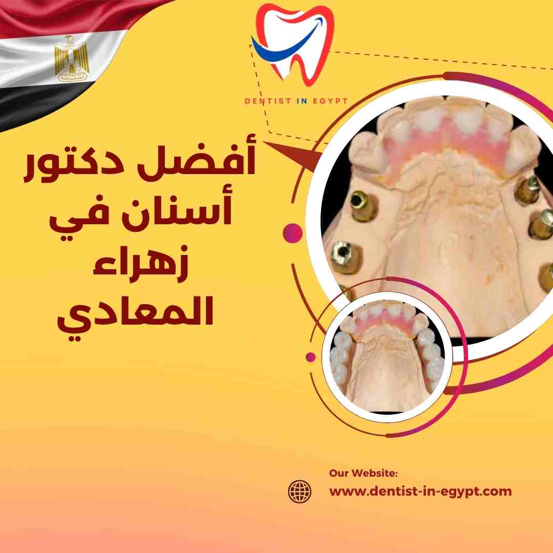 أفضل دكتور أسنان في زهراء المعادي