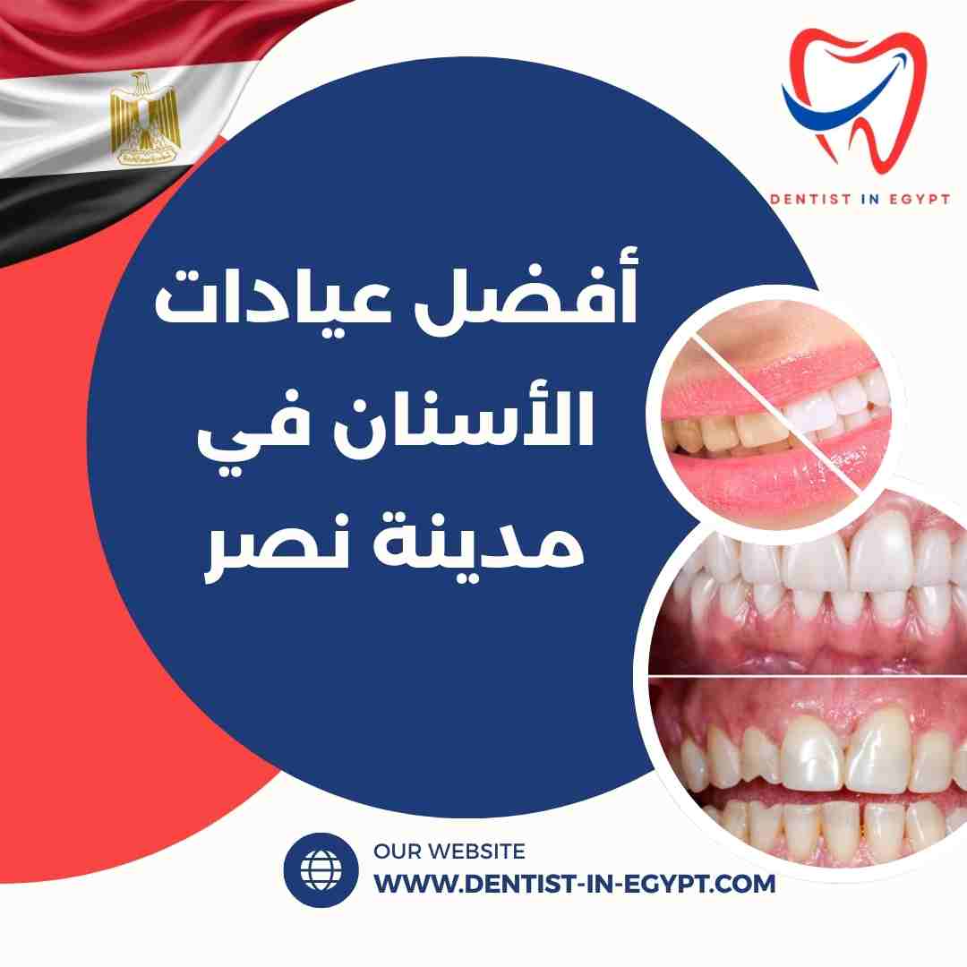 أفضل عيادات الأسنان في مدينة نصر