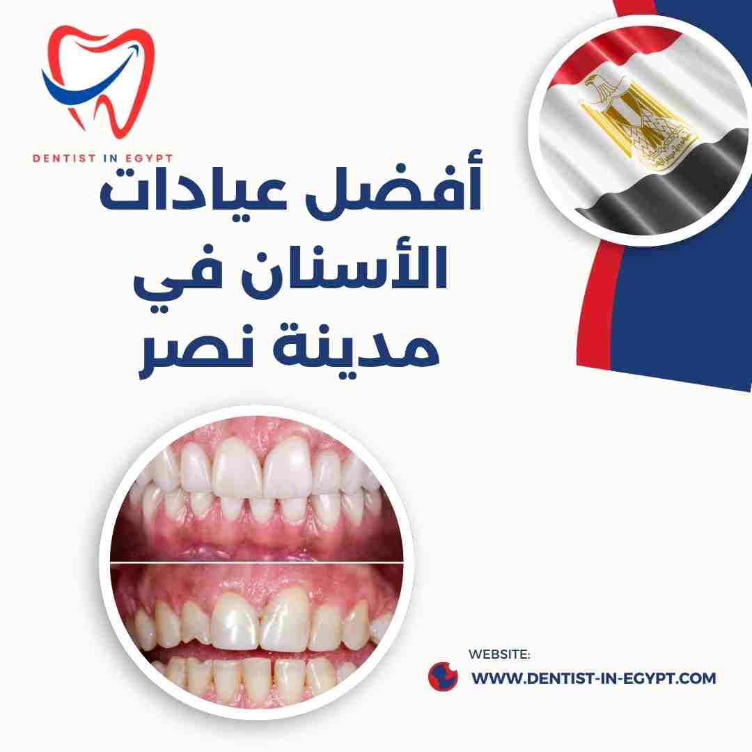 أفضل عيادات الأسنان في مدينة نصر