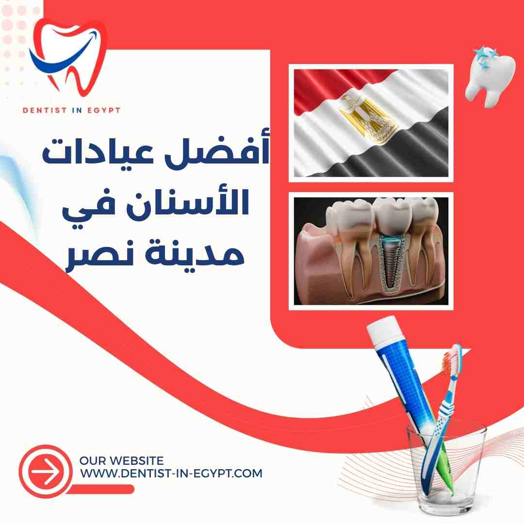 أفضل عيادات الأسنان في مدينة نصر