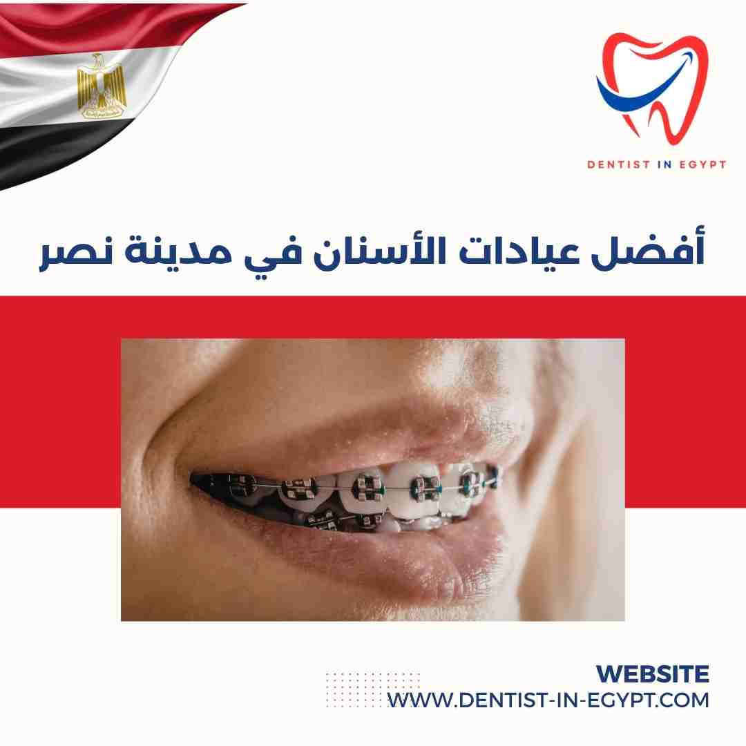 أفضل عيادات الأسنان في مدينة نصر
