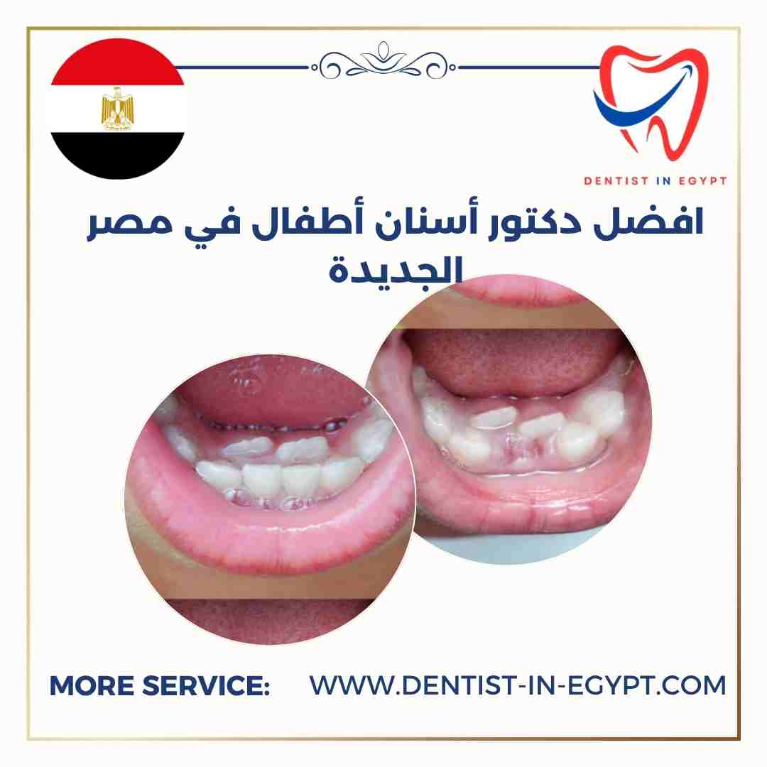 افضل دكتور أسنان أطفال في مصر الجديدة