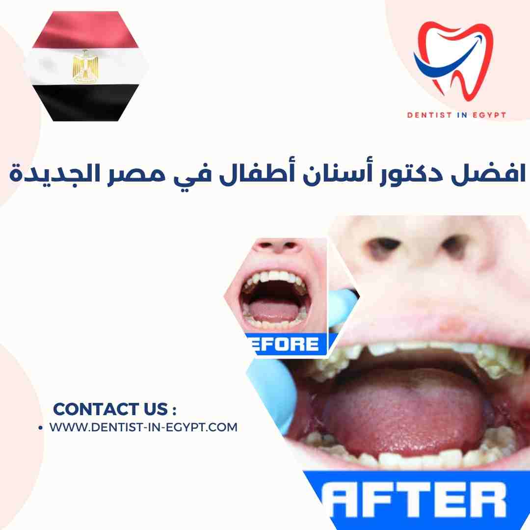 افضل دكتور أسنان أطفال في مصر الجديدة
