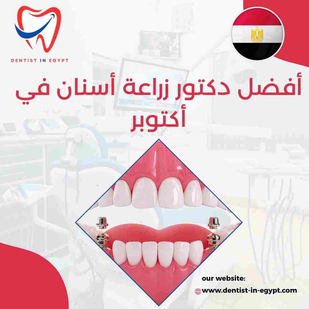 أفضل دكتور زراعة أسنان في أكتوبر