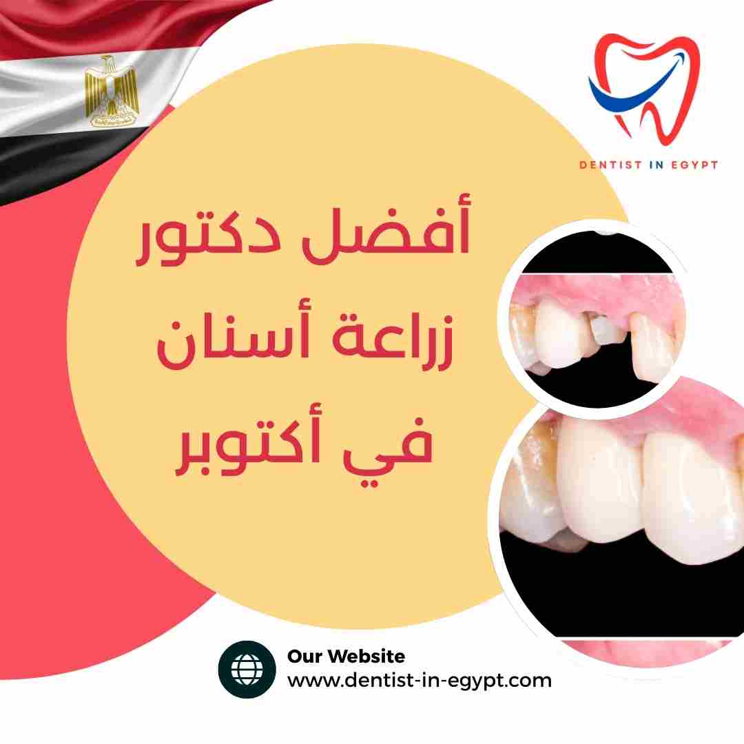أفضل دكتور زراعة أسنان في أكتوبر