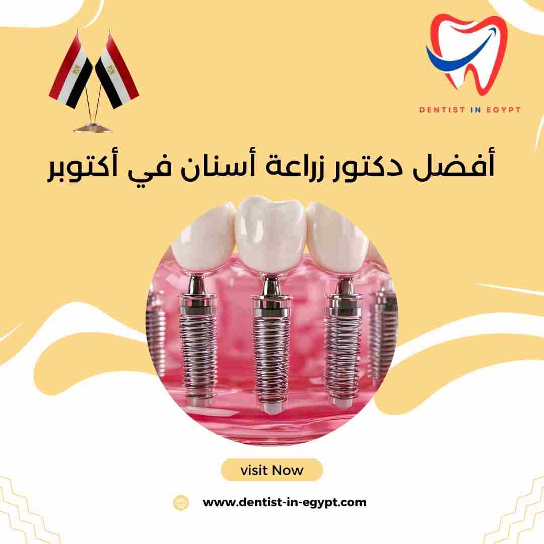 أفضل دكتور زراعة أسنان في أكتوبر
