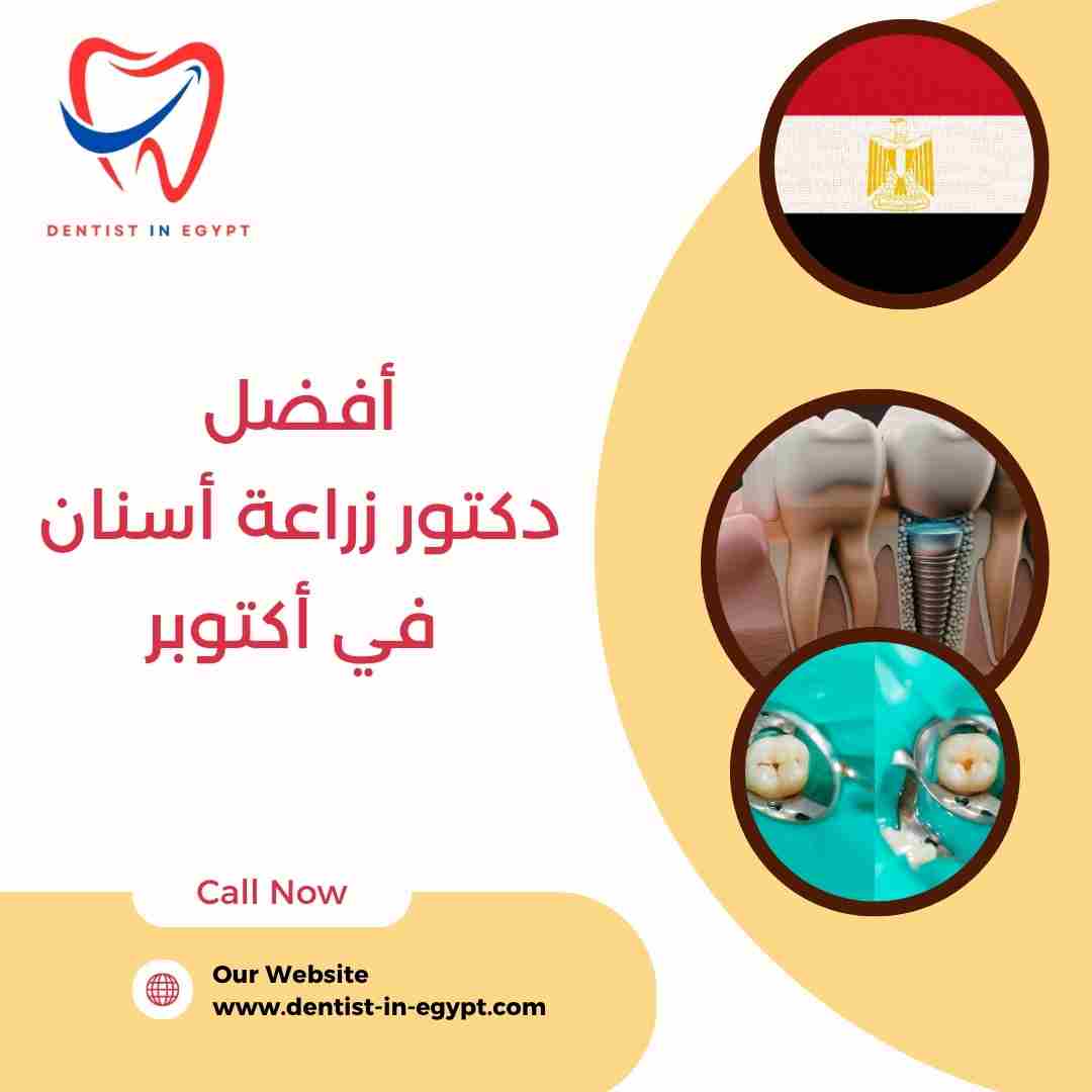 أفضل دكتور زراعة أسنان في أكتوبر