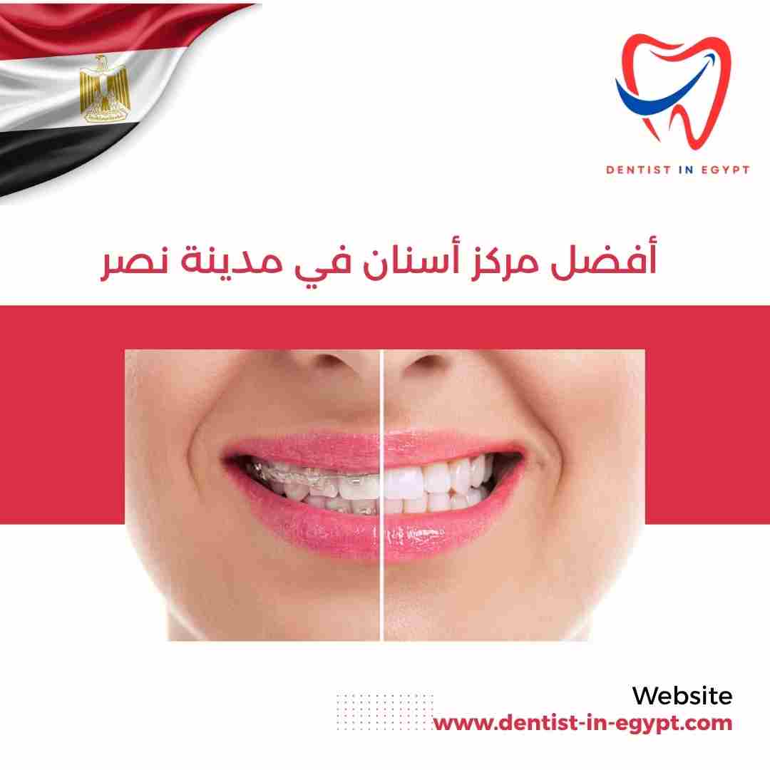 أفضل مركز أسنان في مدينة نصر
