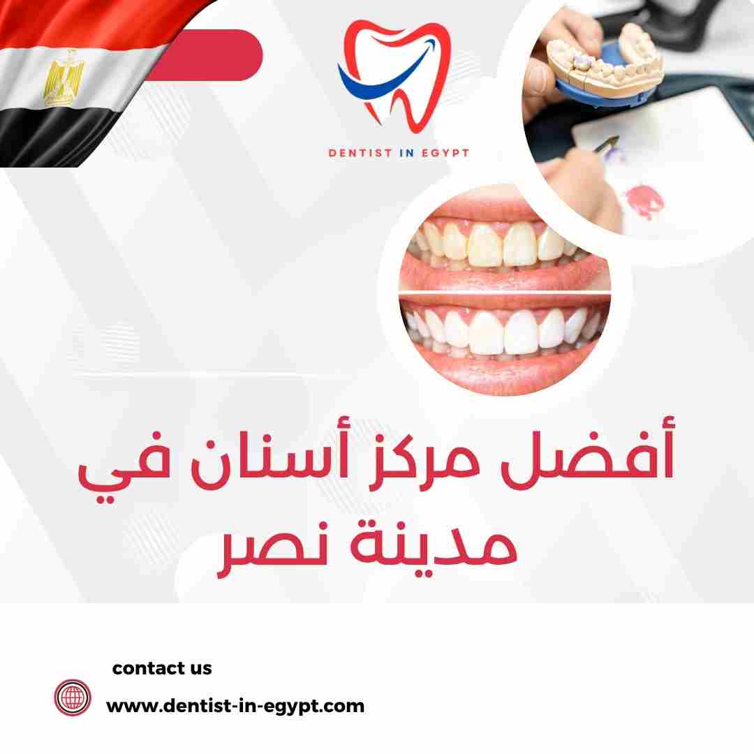 أفضل مركز أسنان في مدينة نصر
