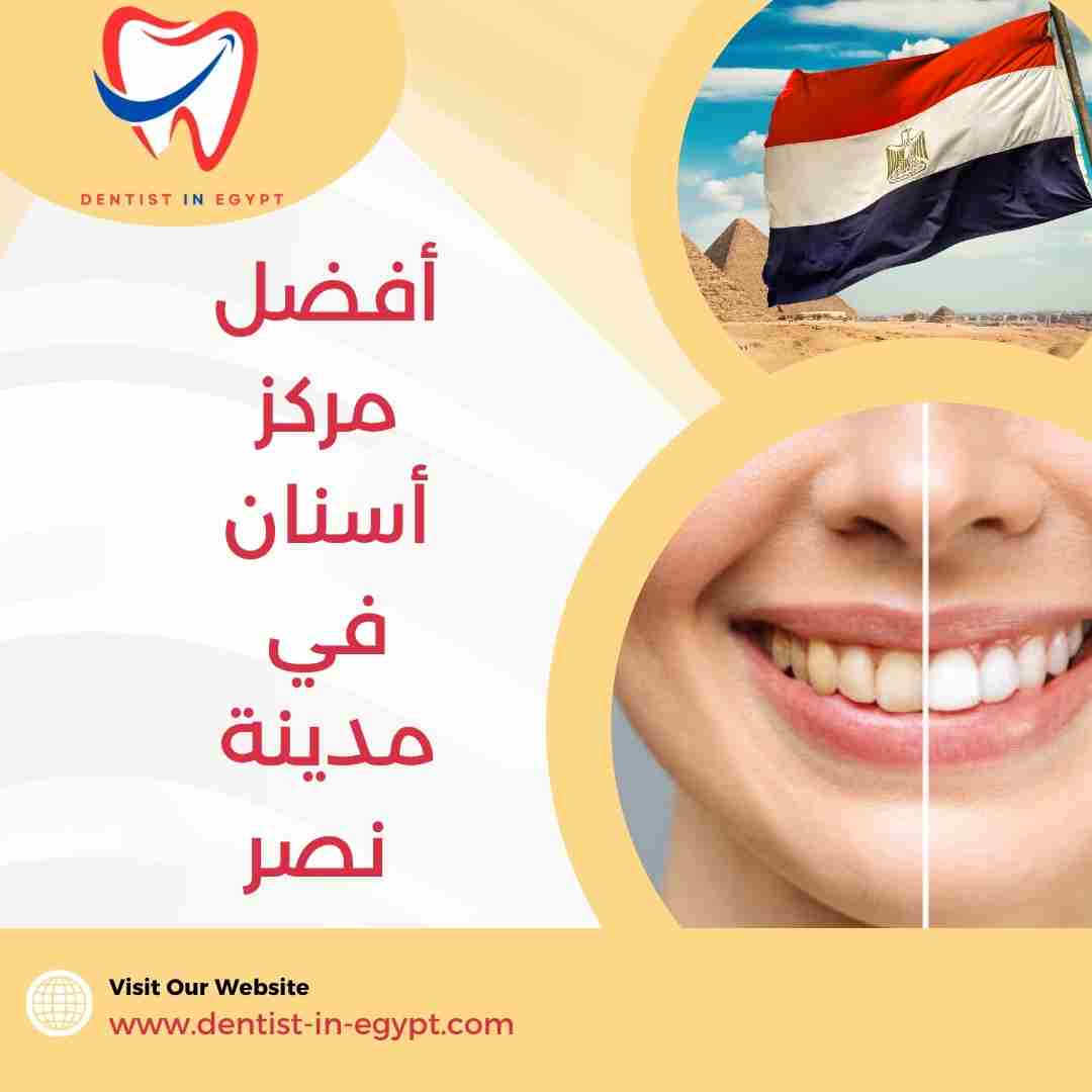 أفضل مركز أسنان في مدينة نصر