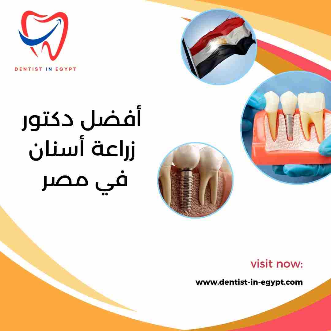 أفضل دكتور زراعة أسنان في مصر