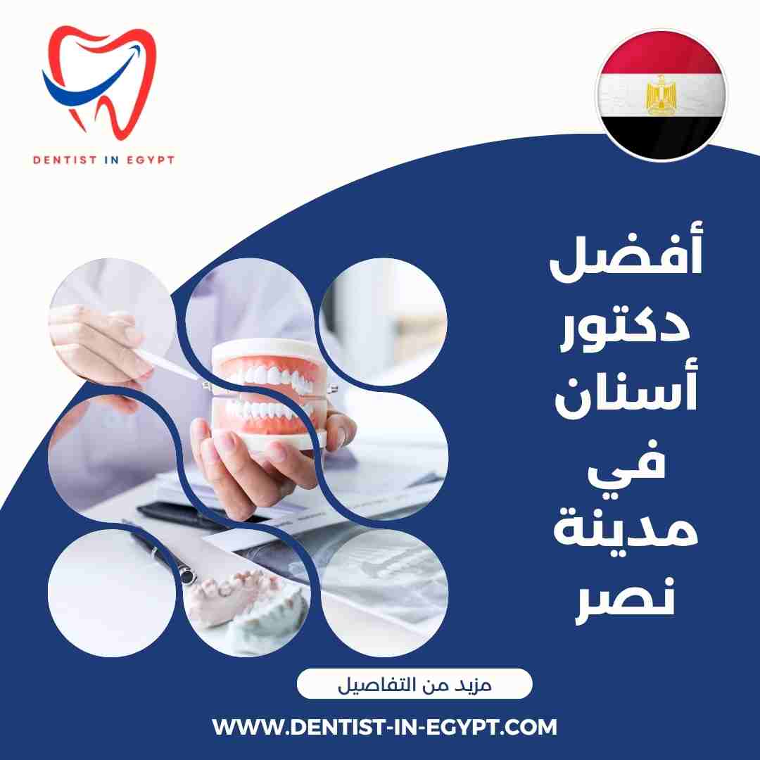 أفضل دكتور أسنان في مدينة نصر