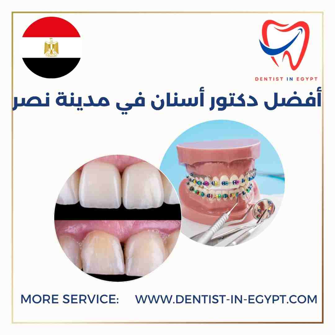 أفضل دكتور أسنان في مدينة نصر