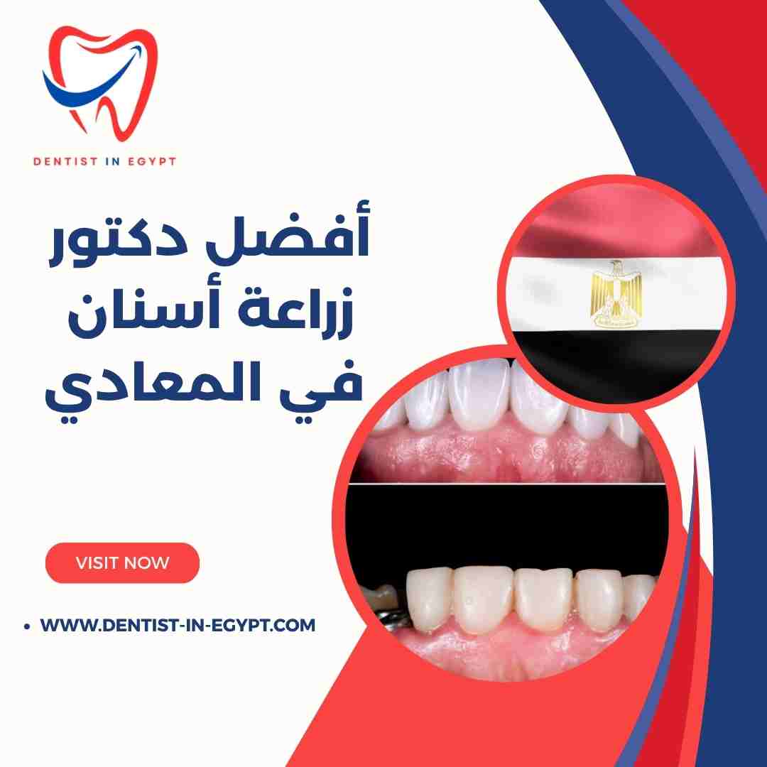 أفضل دكتور زراعة أسنان في المعادي