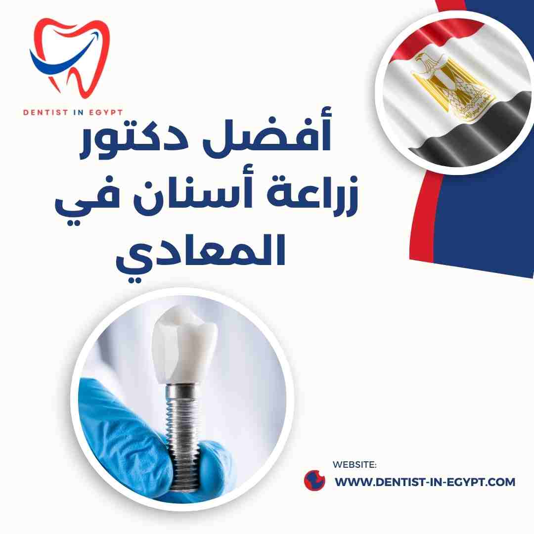 أفضل دكتور زراعة أسنان في المعادي