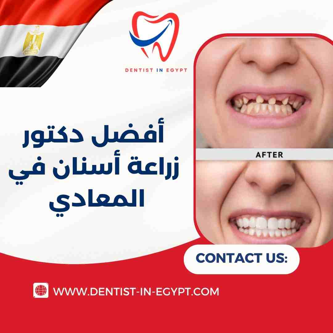 أفضل دكتور زراعة أسنان في المعادي