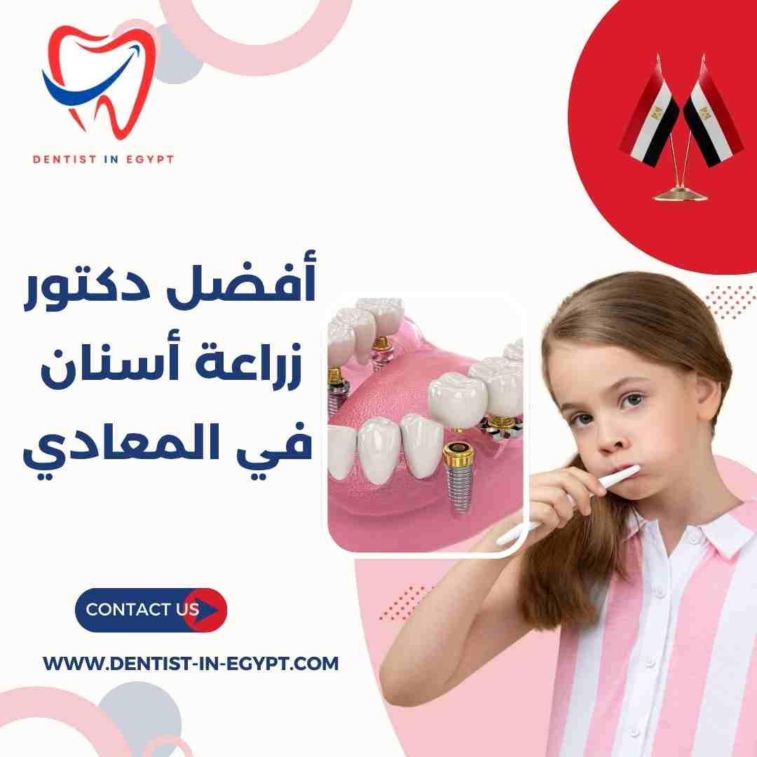 أفضل دكتور زراعة أسنان في المعادي