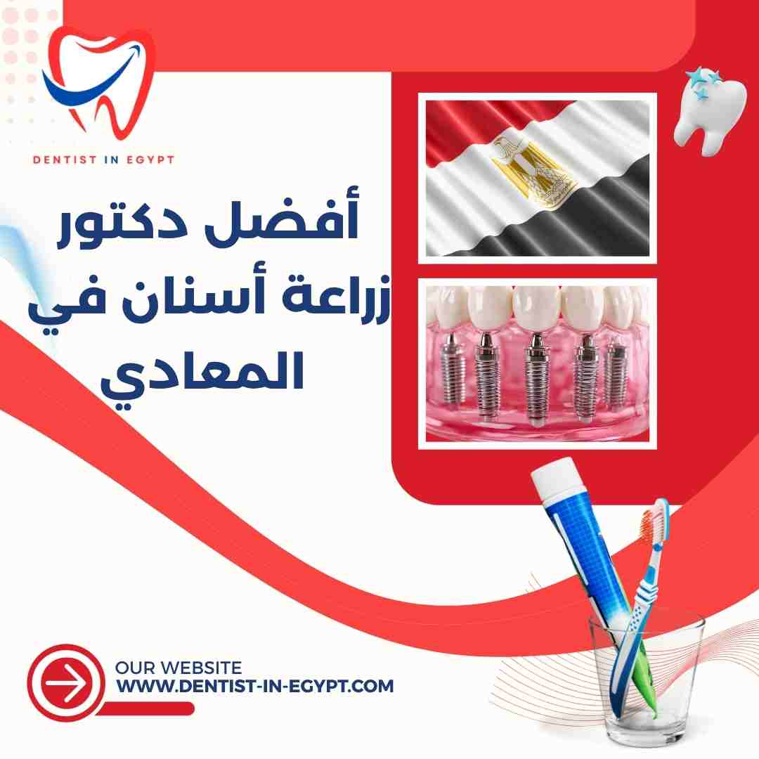 أفضل دكتور زراعة أسنان في المعادي