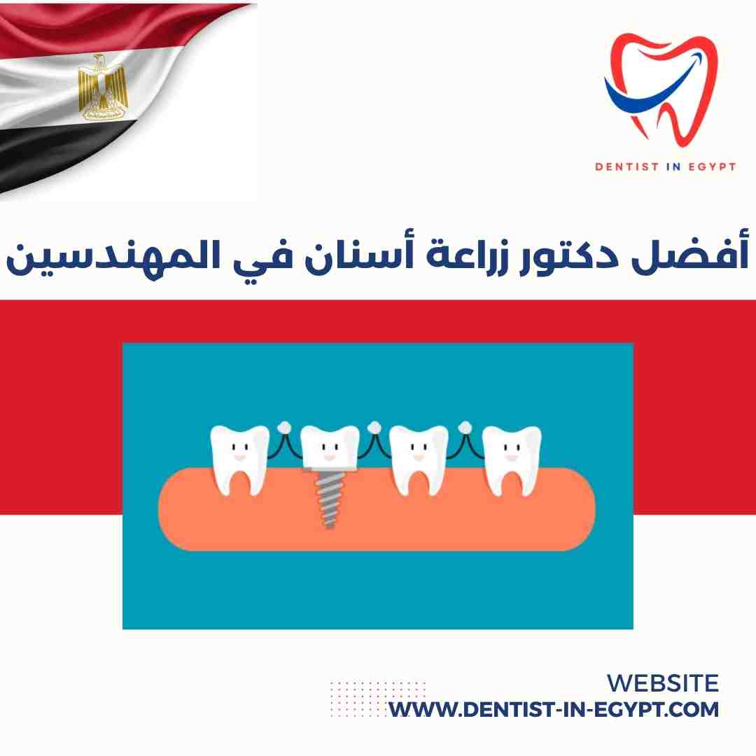 أفضل دكتور زراعة أسنان في المهندسين