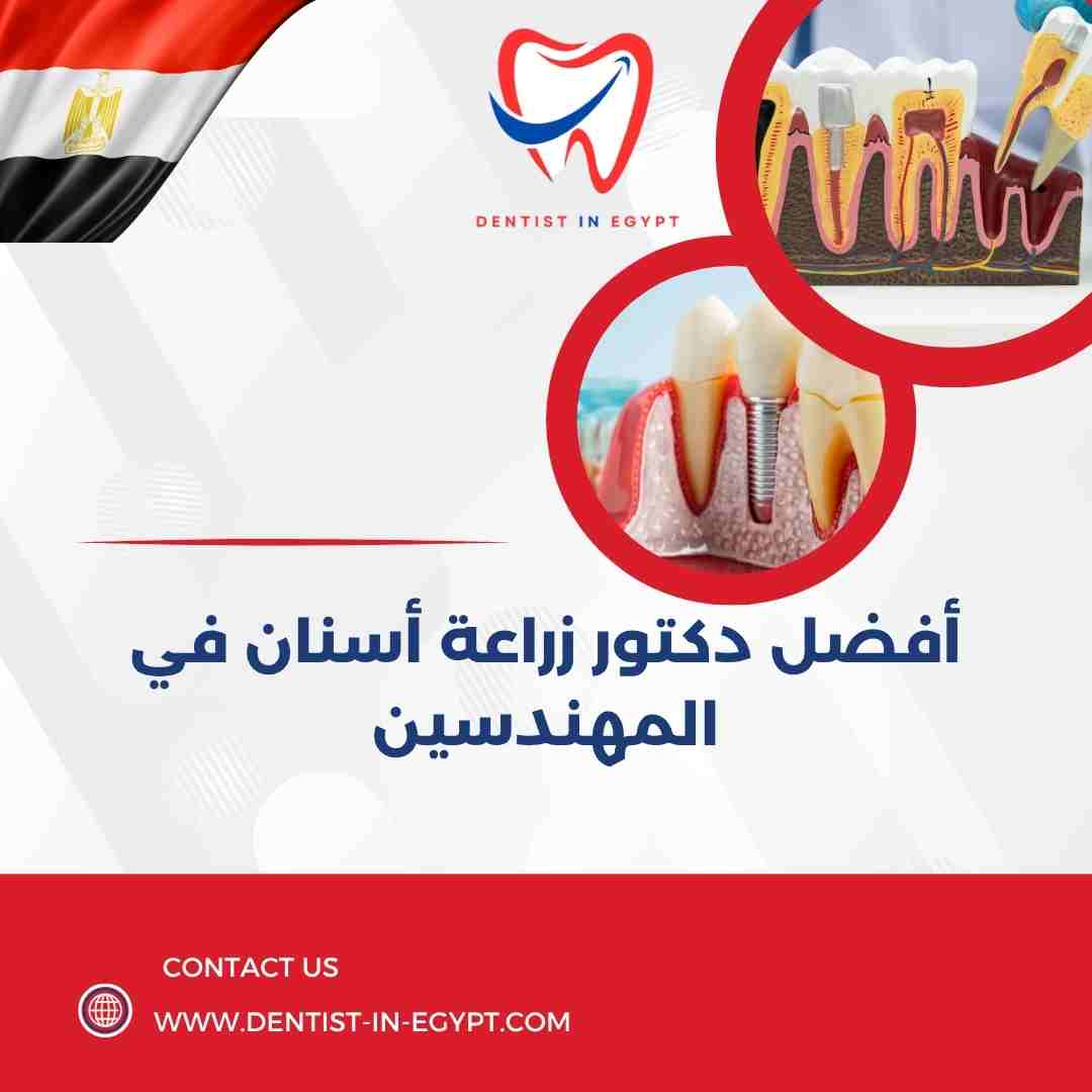 أفضل دكتور زراعة أسنان في المهندسين