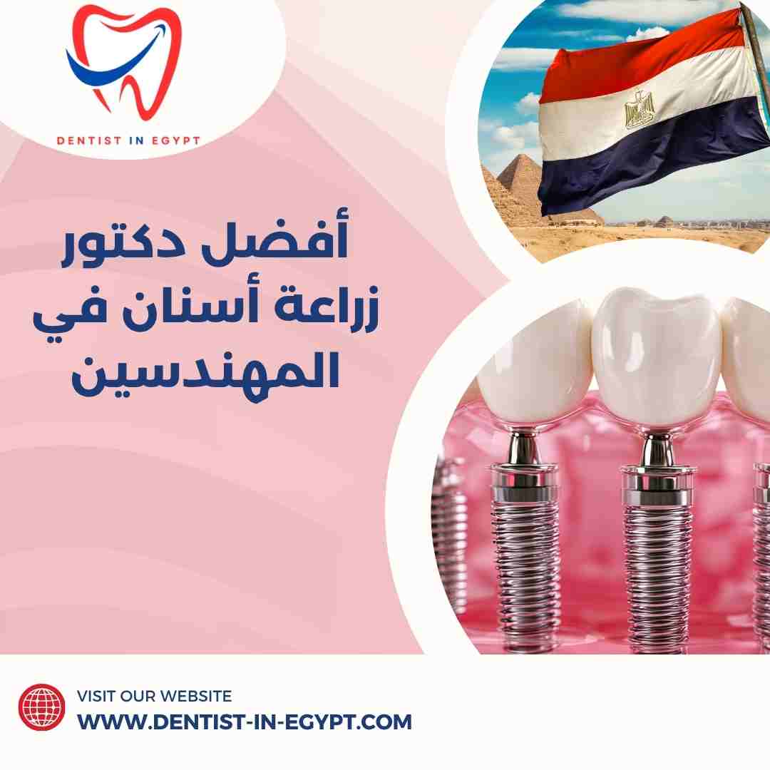 أفضل دكتور زراعة أسنان في المهندسين