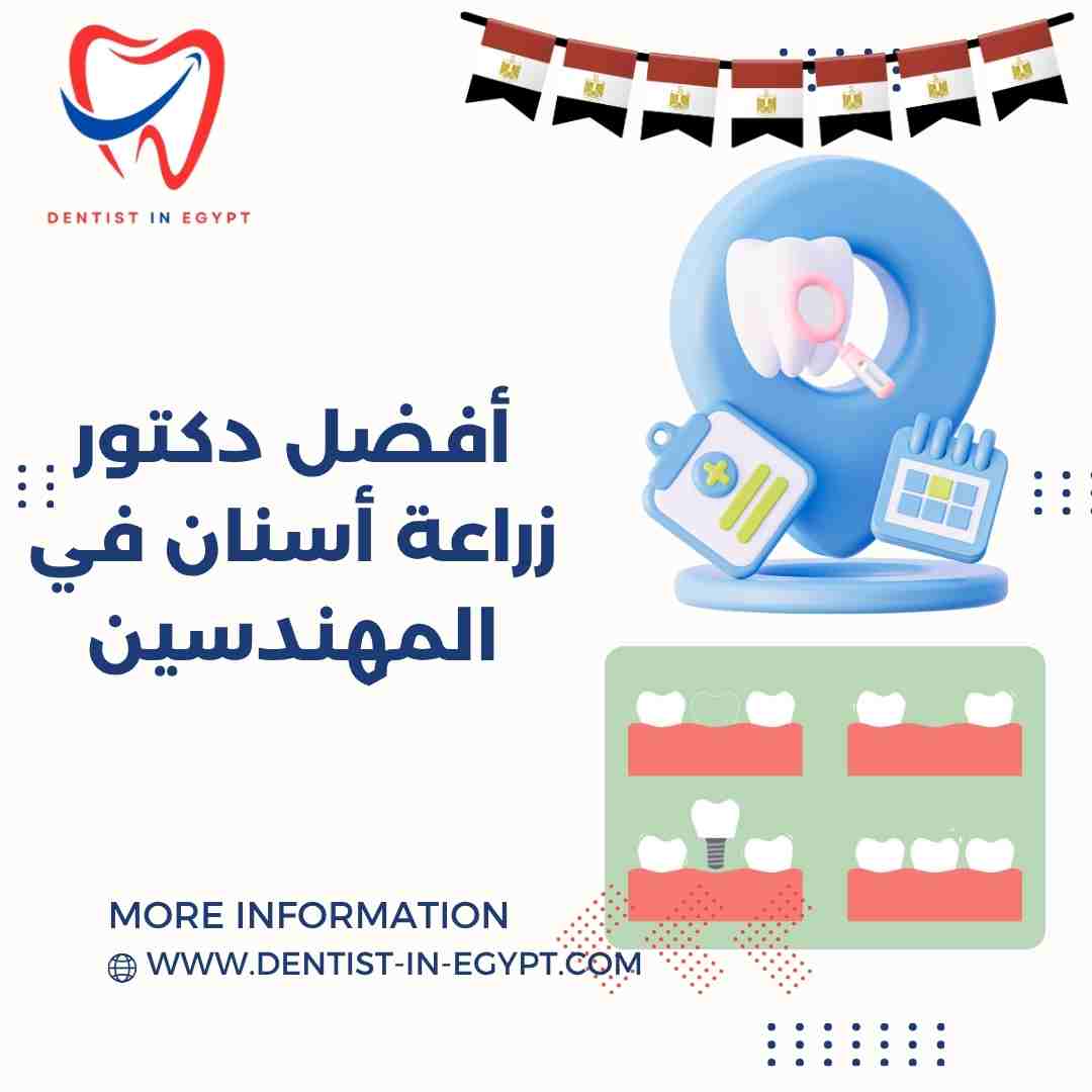 أفضل دكتور زراعة أسنان في المهندسين