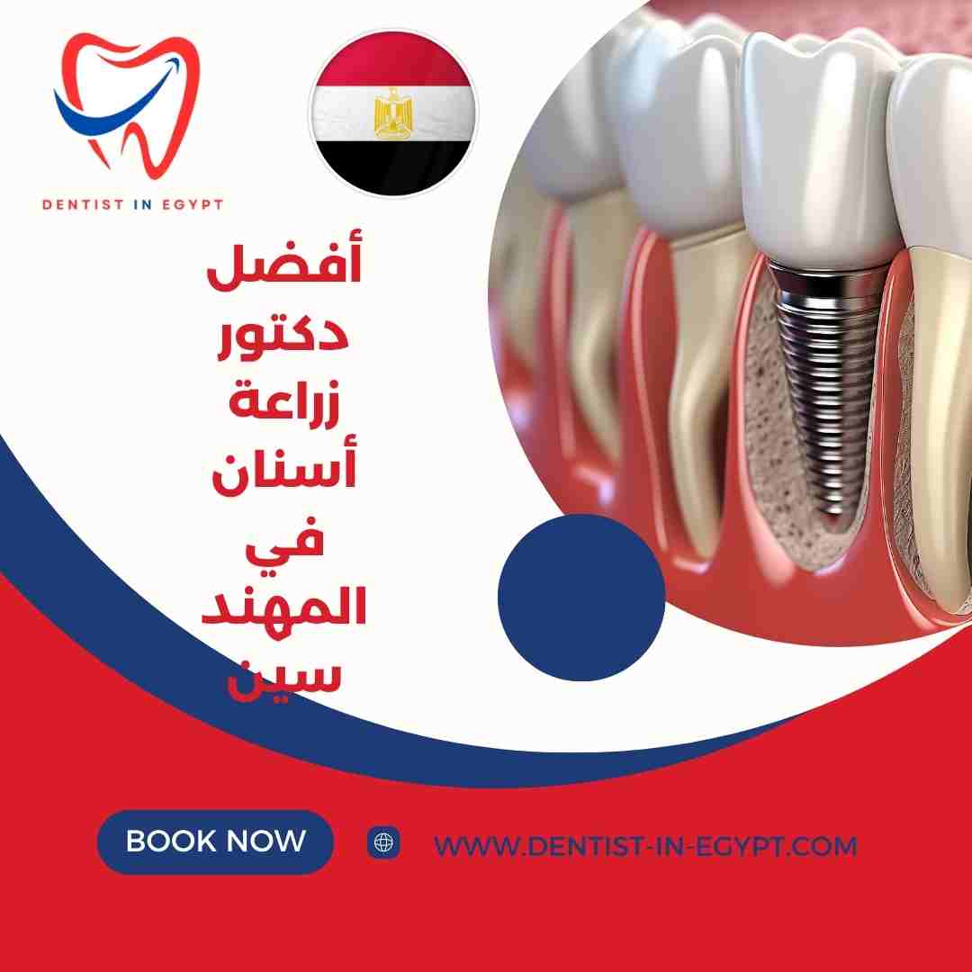 أفضل دكتور زراعة أسنان في المهندسين