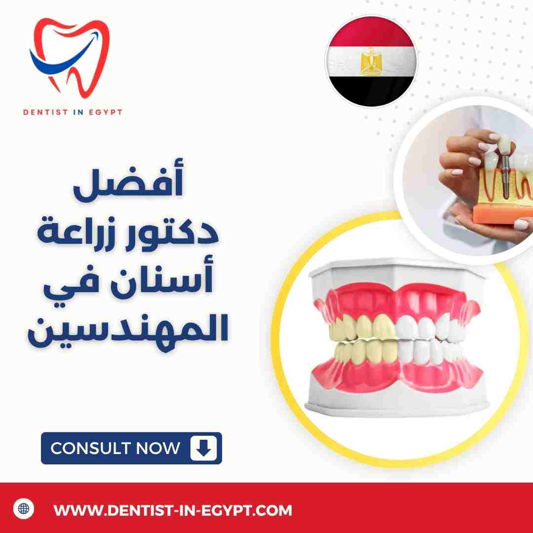 أفضل دكتور زراعة أسنان في المهندسين