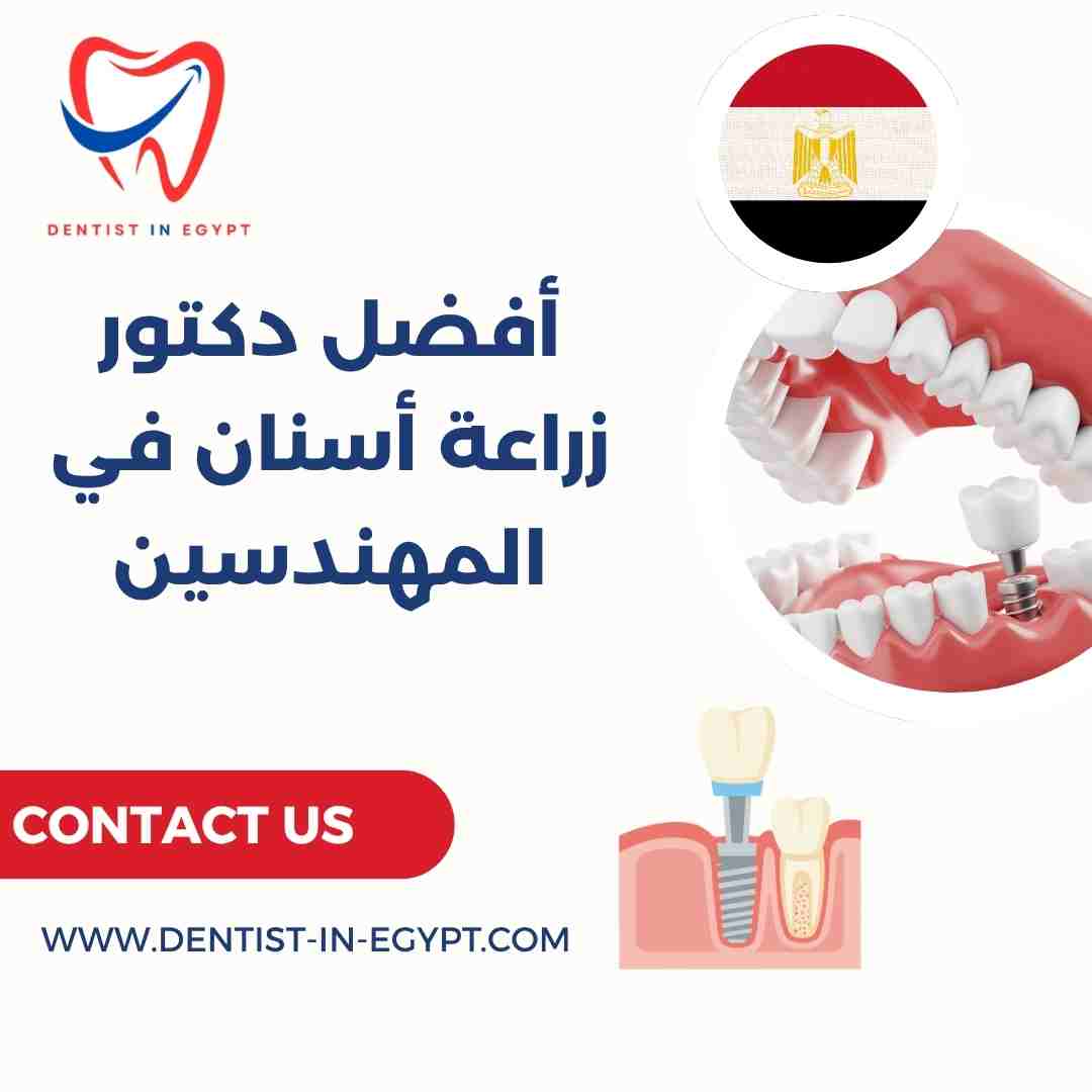 أفضل دكتور زراعة أسنان في المهندسين