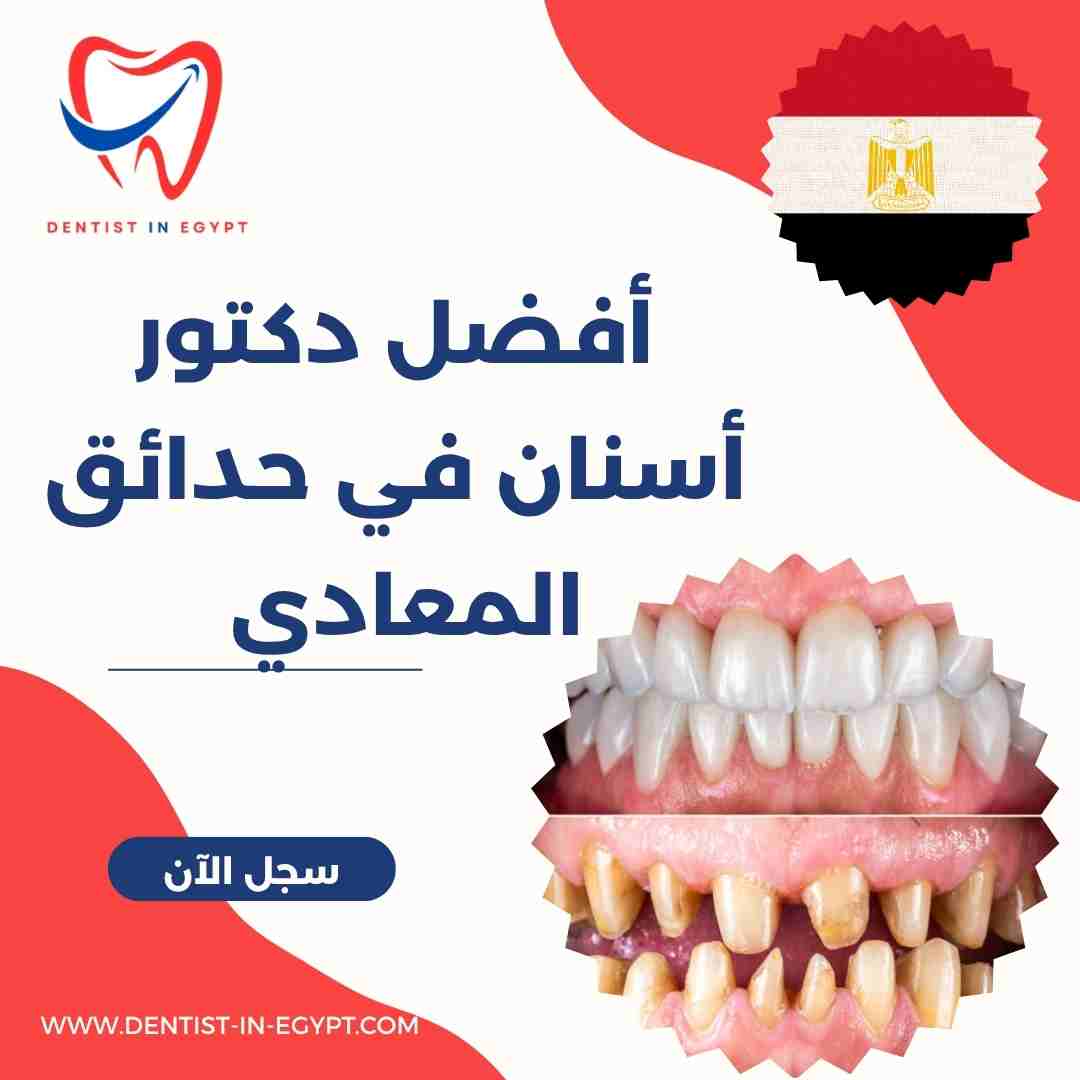 أفضل دكتور أسنان في حدائق المعادي