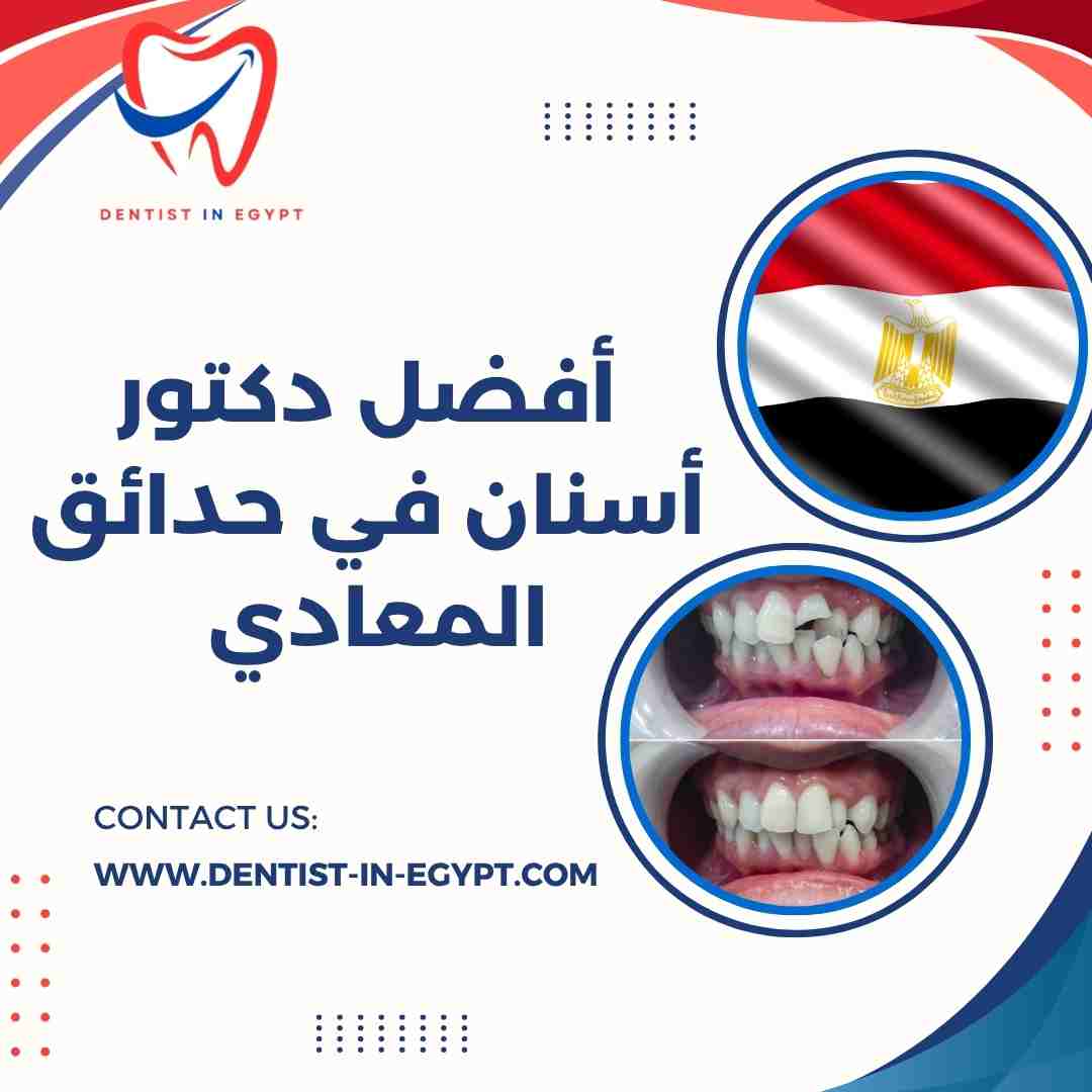 أفضل دكتور أسنان في حدائق المعادي
