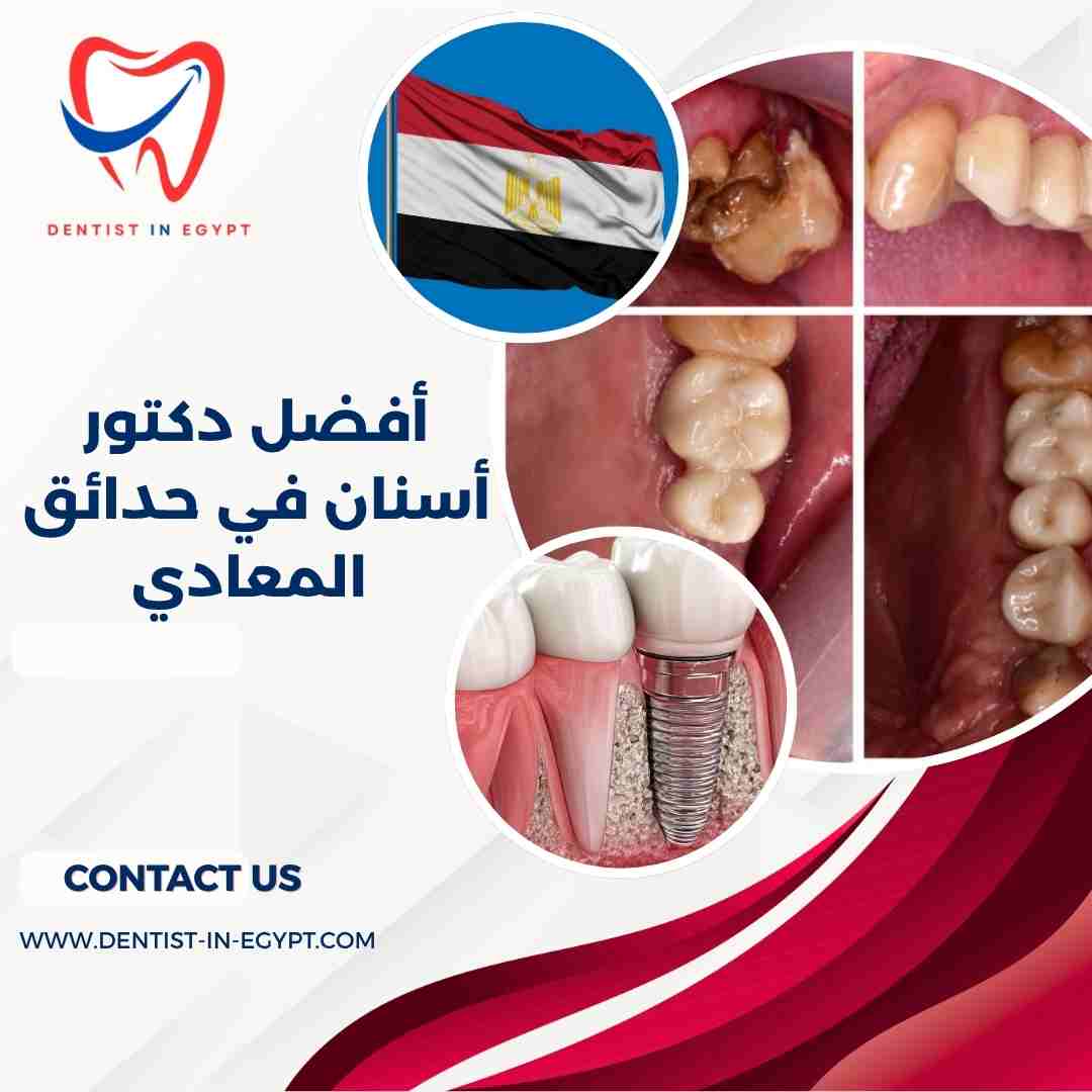 أفضل دكتور أسنان في حدائق المعادي