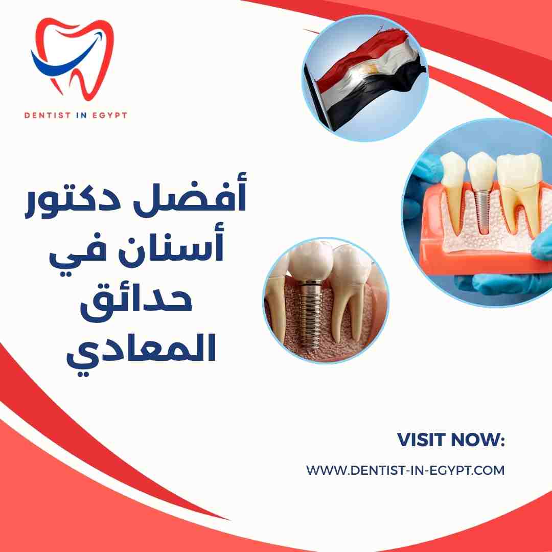 أفضل دكتور أسنان في حدائق المعادي