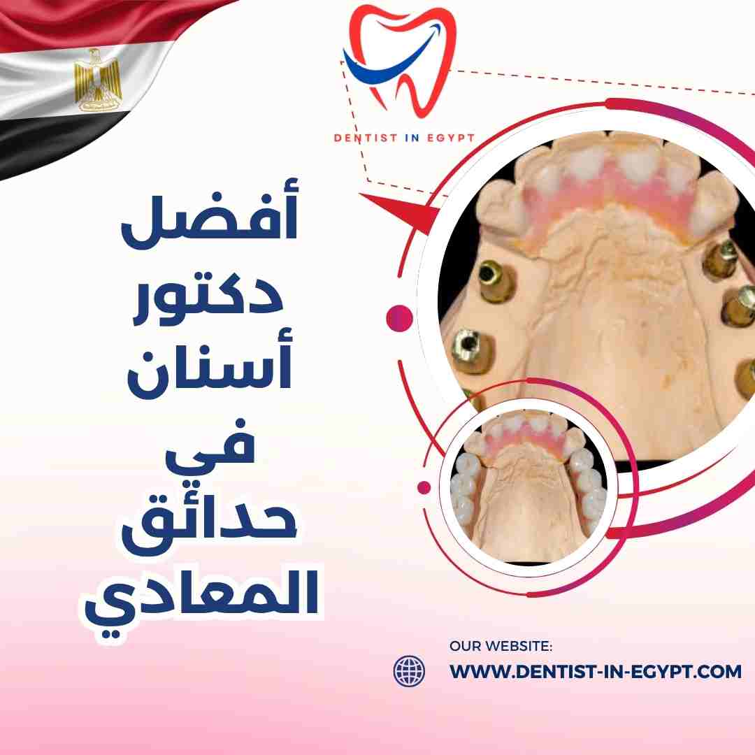 أفضل دكتور أسنان في حدائق المعادي