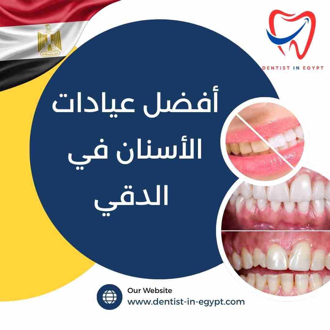 أفضل عيادات الأسنان في الدقي