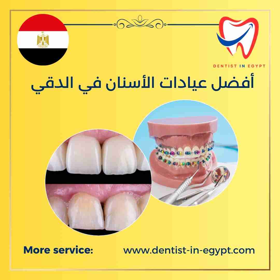 أفضل عيادات الأسنان في الدقي