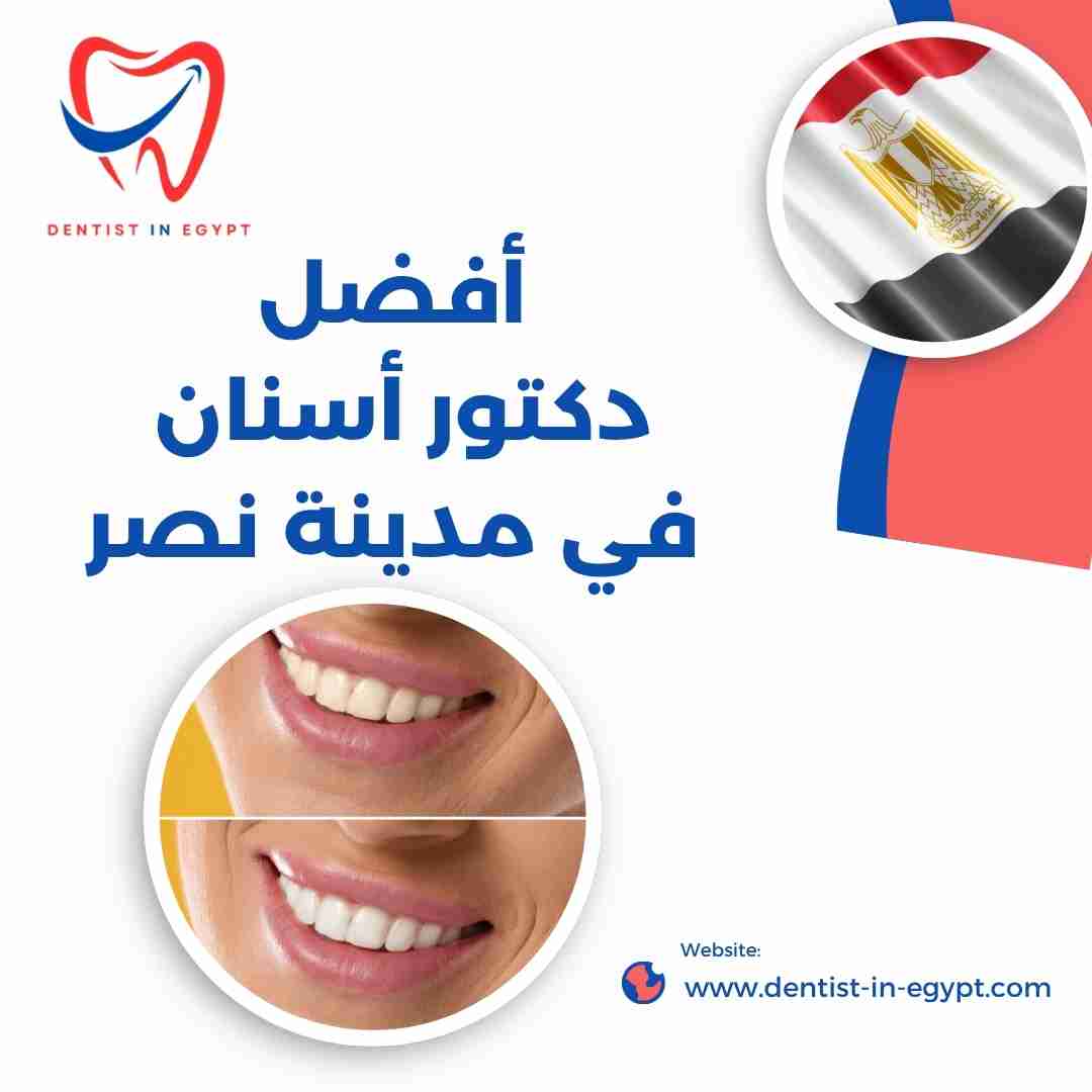 أفضل دكتور أسنان في مدينة نصر