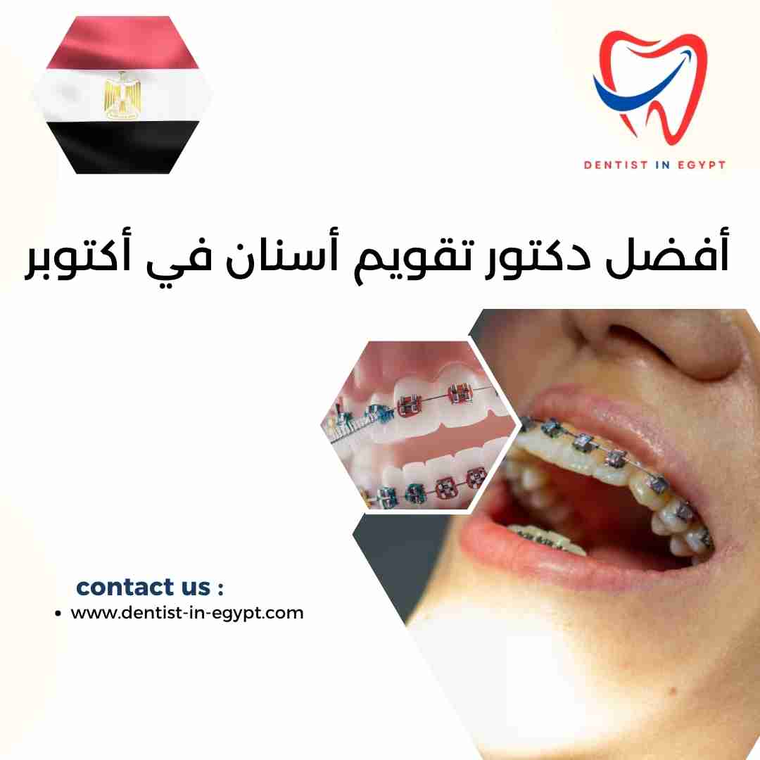 أفضل دكتور تقويم أسنان في أكتوبر